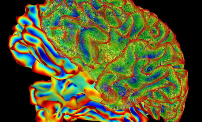 Искусственный интеллект попросили показать, как выглядят мысли людей и отправили в нейросеть записи с МРТ