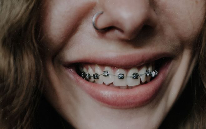 Фото: Pexels