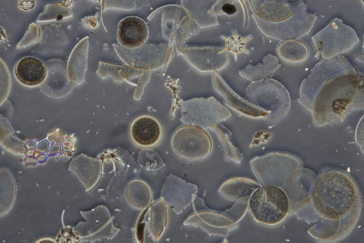 Вода из пруда под микроскопом фото
